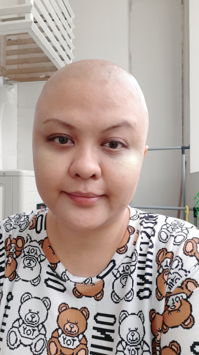 DcTene's tweet photo. I'm going to have my 6th and hopefully, final chemotherapy in a few days.

IT'S BEEN A DIFFICULT 8 MONTHS FOR ME.

Just thinking about how mothafckers had the nerve to steal funds meant for cancer patients makes my blood boil. 

Ang kakapal ng pagmumukha niyo! https://t.co/E8euyqQD1y
