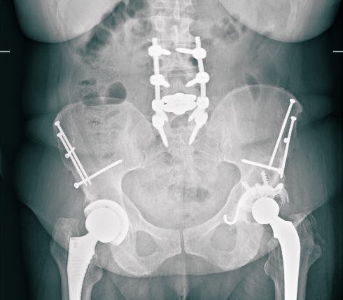 A.T. Mameghani, MD 🇨🇭🇺🇦🇮🇱 tweet media