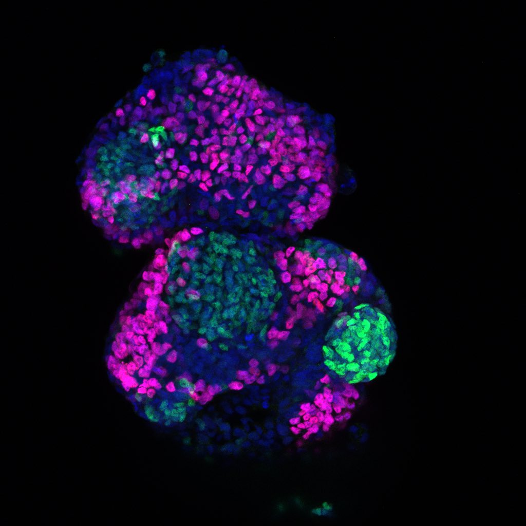 KerosuoLab's tweet image. Happy Fluorescence Friday from the Kerosuo Lab! While we aim to smoothly fly into 2023, this guy is falling down mouth open and with panic in their eyes - just a picture and hopefully not an omen. #FluorescenceFriday #NeuralCrest