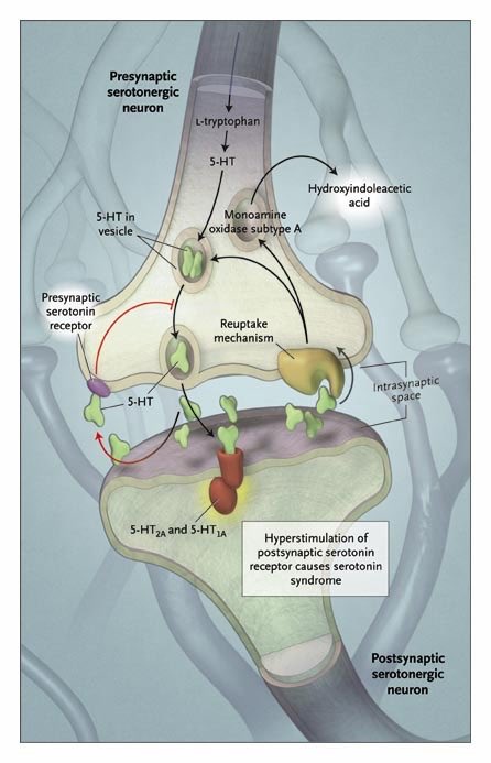 Innov_Medicine's tweet photo. The Serotonin Syndrome @NEJM
Serotonin syndrome is a serious drug reaction. It is caused by medications that build up high levels of serotonin in the body.
https://t.co/bUoTjshKjE https://t.co/IEAvNlaKPW