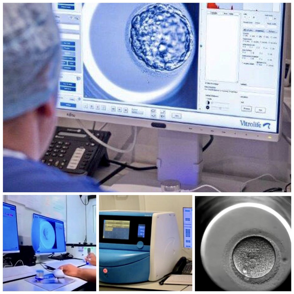 BCRMFertility's tweet photo. Five star hotel for embryos : https://t.co/dDXTdiWx0y
@ivfbabble @NSHCS #bcrm #fertilityawareness #embryoscope #ttccommunity #ttc #ttcjourney #fertility #fertilitytreatment https://t.co/zLnYGlROAm