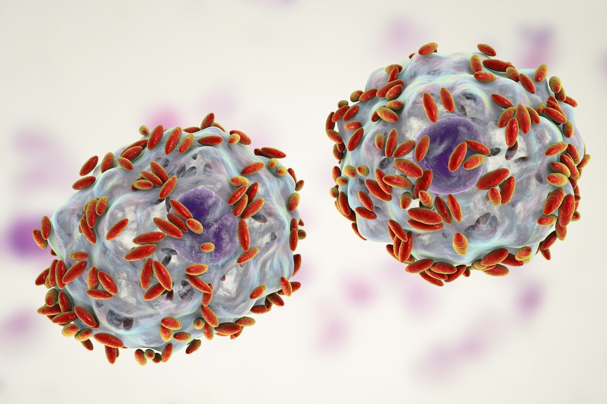 1Antruk's tweet photo. New #askARUK question "I have recently been diagnosed with bacterial vaginosis; does this require treatment with antibiotics?β Find the answer here https://t.co/qtuN9BvqyK #Antibiotics #BV https://t.co/zFmXM4loRU