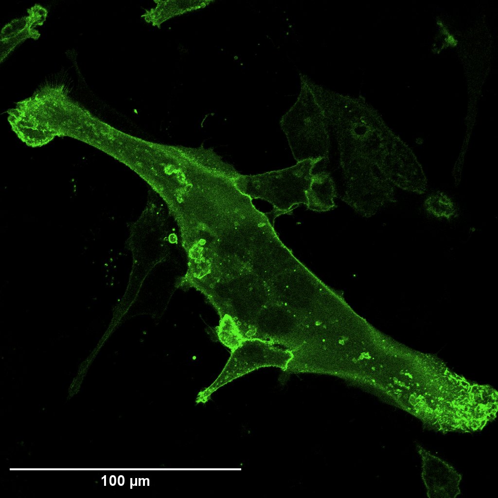 EMandrou's tweet photo. @BakalLabICR I don't know if cancer cells care what size they are. At least it doesn't seem to be the case with the PDAC cell line I'm using. 3 different categories of size in 1 image: https://t.co/7MVzI7t38x