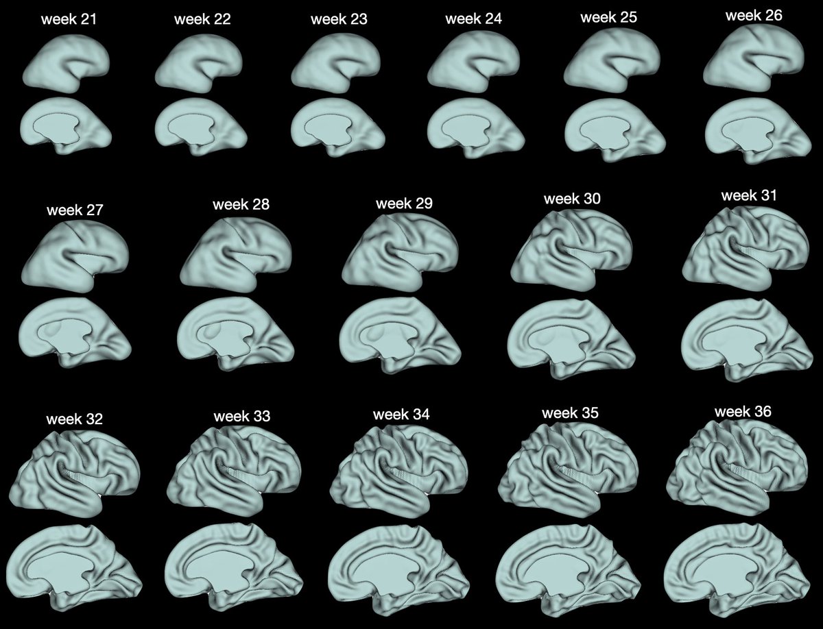 King’s Perinatal Functional Imaging Group (@kings_pfig) on Twitter photo Excited to share this beautiful fetal brain surface atlas from the <a href="/DevelopingHCP/">DevelopingConnectome</a>
kcl_cdb/dhcp_fetal_brain_surface_atlas: Fetal brain surface atlas, weeks 21-36 of gestation, constructed using 242 in-utero scans from fetal dHCP cohort - G-Node GIN gin.g-node.org/kcl_cdb/dhcp_f… Excited to share this beautiful fetal brain surface atlas from the <a href="/DevelopingHCP/">DevelopingConnectome</a>
kcl_cdb/dhcp_fetal_brain_surface_atlas: Fetal brain surface atlas, weeks 21-36 of gestation, constructed using 242 in-utero scans from fetal dHCP cohort - G-Node GIN gin.g-node.org/kcl_cdb/dhcp_f…