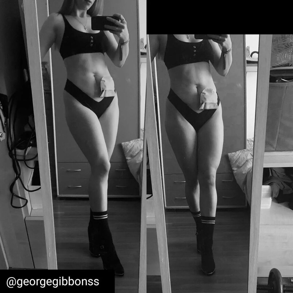 IBDSuperHeroes's tweet photo. IBDSuperHeroes shares 💜
Reposted from @georgegibbonss Scars are battle wounds; our body’s map of the journey we have been on 🖤

#crohnsdisease #stoma #realbodies #strongnotskinny #crohnsdisease #crohns #crohnswarrior #ibdawareness #ibdwarrior #ibdsup… https://t.co/dYcA46XbWo https://t.co/og4g0WyUf6