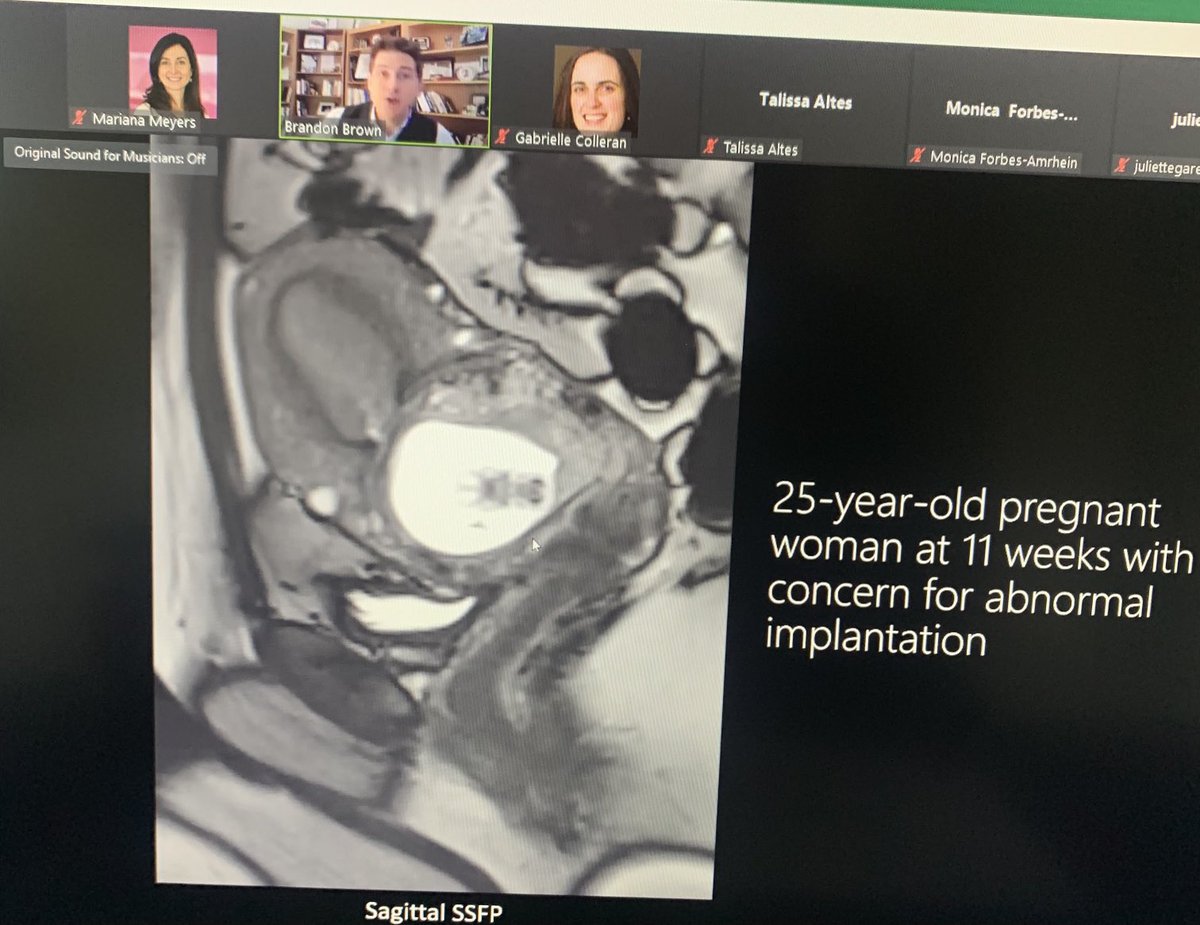 Mariana Meyers (@marianazmeyers) on Twitter photo Amazing morning for the first day of the #SPRFetal2023 with amazing speakers on my favorite topic: PLACENTA! <a href="/brandonbrownmd/">Brandon Brown</a> <a href="/GColleranMD/">Gabrielle Ní Challaráin</a> Chris Cassady Amazing morning for the first day of the #SPRFetal2023 with amazing speakers on my favorite topic: PLACENTA! <a href="/brandonbrownmd/">Brandon Brown</a> <a href="/GColleranMD/">Gabrielle Ní Challaráin</a> Chris Cassady