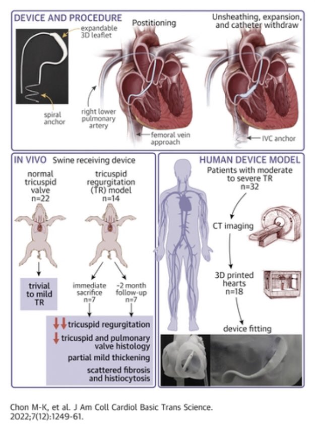 A novel #spacer to treat #pcrtricuspid regurgitation with the potential of being an all-comer device

#echofirst #yescct

jacc.org/doi/10.1016/j.…

@JACCJournals @ACCinTouch