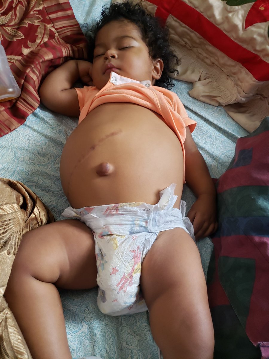 glenda_ovalles's tweet photo. Dios mio se que debemos esperar los tramite pero el esta muy mal de salud tenemos miedo a lo peor esta últimas semanas  no duerme bien no come y va mal fiebre congestión  y pasa el día quejándose me parte el alma cuando me mira expresando su dolor.@raquelarbaje https://t.co/EObxOZnoqy