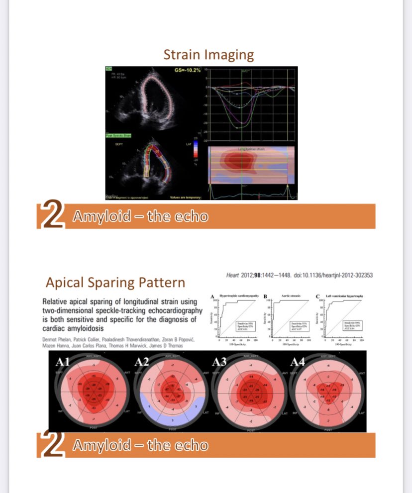 Sharon Mulvagh MD FRCPC FASE FACC (@heartdocsharon) on Twitter photo Excellent and beautiful overview on #cardiacAmyloidosis by <a href="/ScaliaGreg/">Greg Scalia</a> at 🏝️#EchoHawaii - the essential role of #EchoFirst in diagnosing and managing this now treatable disease <a href="/MarthaGrogan1/">Martha Grogan MD</a> <a href="/Amyloidosisfdn/">Amyloidosis</a> <a href="/JLindnerMD/">JLindnerMD</a> <a href="/JamesDThomasMD1/">James D Thomas, MD</a> Excellent and beautiful overview on #cardiacAmyloidosis by <a href="/ScaliaGreg/">Greg Scalia</a> at 🏝️#EchoHawaii - the essential role of #EchoFirst in diagnosing and managing this now treatable disease <a href="/MarthaGrogan1/">Martha Grogan MD</a> <a href="/Amyloidosisfdn/">Amyloidosis</a> <a href="/JLindnerMD/">JLindnerMD</a> <a href="/JamesDThomasMD1/">James D Thomas, MD</a>