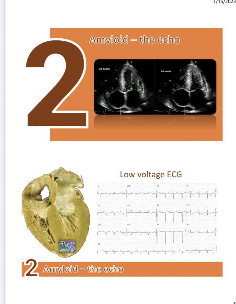 Sharon Mulvagh MD FRCPC FASE FACC tweet media