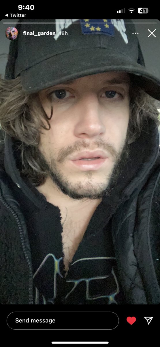 ranchismyonlyf's tweet photo. he got those lana lip filler special 😂 https://t.co/jHUIKtPgNa