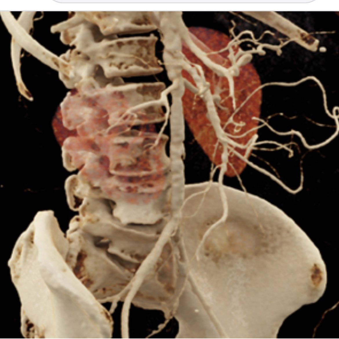 Celebrating Uniqueness: The Unusual Award N.13 For Extreme Gluteal
