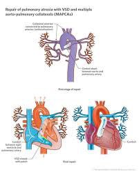 Top question for any cardiologist out there how do you fix this ….