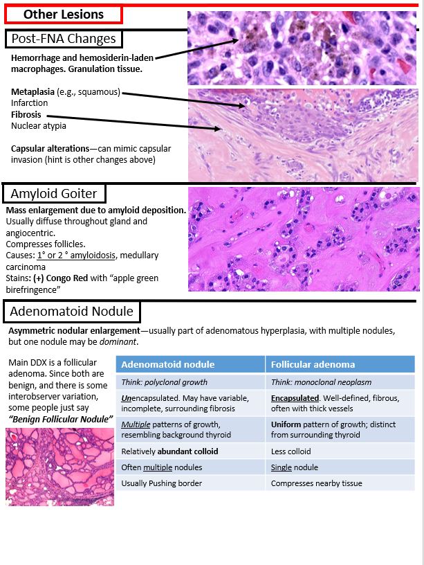 Kurt Schaberg (@kurtschaberg) on Twitter photo I finished my notes on non-neoplastic (medical) thyroid for my teaching website "Kurt's Notes" (kurtsnotes.net).
π¬π¬π¬π¬π¬π¬π¬π¬π¬π¬π¬π¬π¬π¬π¬π¬π¬π¬π¬π¬π¬π¬π¬π¬π¬π¬π¬π¬π¬π¬π¬π¬
Full notes available here: schaberg.faculty.ucdavis.edu/wp-content/upl⦠I finished my notes on non-neoplastic (medical) thyroid for my teaching website "Kurt's Notes" (kurtsnotes.net).
π¬π¬π¬π¬π¬π¬π¬π¬π¬π¬π¬π¬π¬π¬π¬π¬π¬π¬π¬π¬π¬π¬π¬π¬π¬π¬π¬π¬π¬π¬π¬π¬
Full notes available here: schaberg.faculty.ucdavis.edu/wp-content/uplβ¦