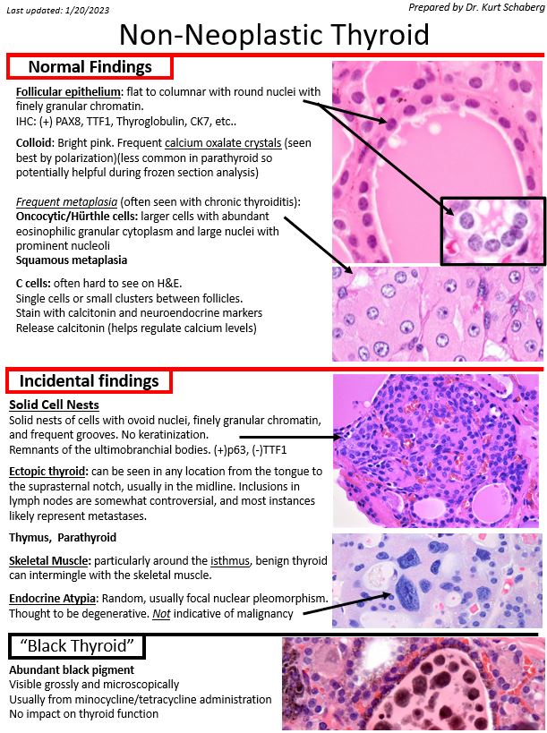 Kurt Schaberg tweet media