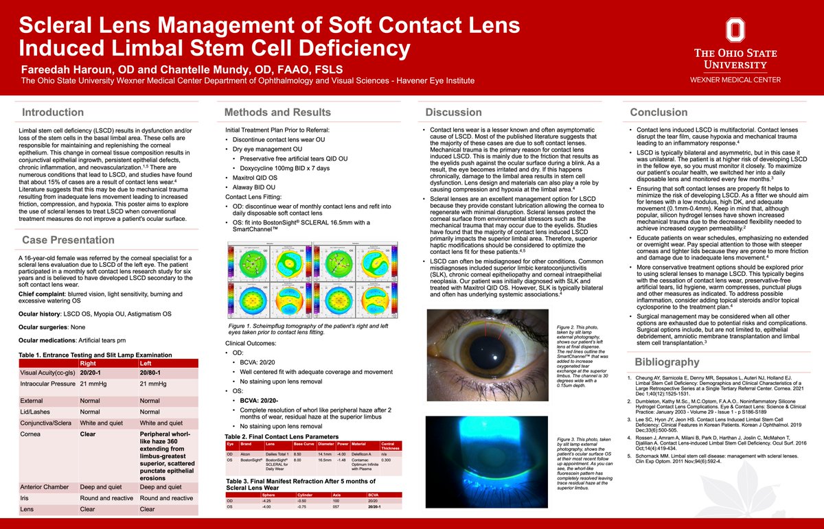 GSLSymposium's tweet photo. Congratulations, #GSLS2023 poster winners! 

2nd place—clinical case report (resident first author): Scleral Lens Management of Soft Contact Lens Induced Limbal Stem Cell Deficiency

By Fareedah Haroun, OD; Chantelle Mundy, OD

@CLS_magazine @OSUWexMed

https://t.co/xqUIEp4XKo https://t.co/zBHoMd6ZCV