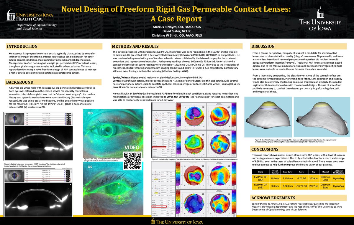 GSLSymposium's tweet photo. Congratulations, #GSLS2023 poster winners! 

1st place—clinical case report (nonresident first author): Novel Design of Freeform Rigid Gas Permeable Contact Lenses

By Marcus Noyes, OD; David Slater; &amp; Christine Sindt, OD

@CLS_magazine @uiowaeye 

https://t.co/xqUIEp4XKo https://t.co/xXEAchEdia