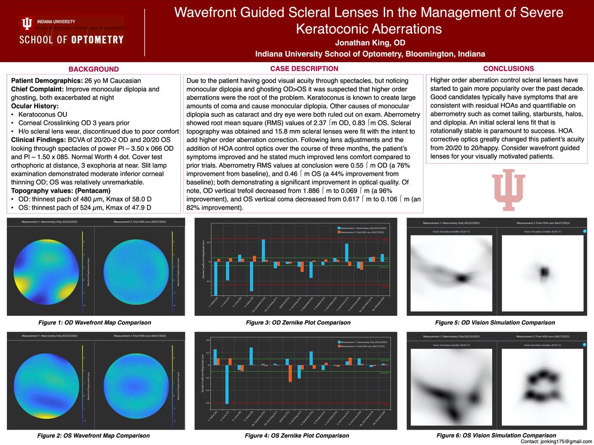 GSLSymposium's tweet photo. Congratulations, #GSLS2023 poster winners! 

2nd place—clinical case report (nonresident first author): Wavefront Guided Scleral Lenses In the Management of Severe Keratoconic Aberrations

By Jonathan King, OD

@CLS_magazine https://t.co/xqUIEp4XKo https://t.co/J6awle4k5M