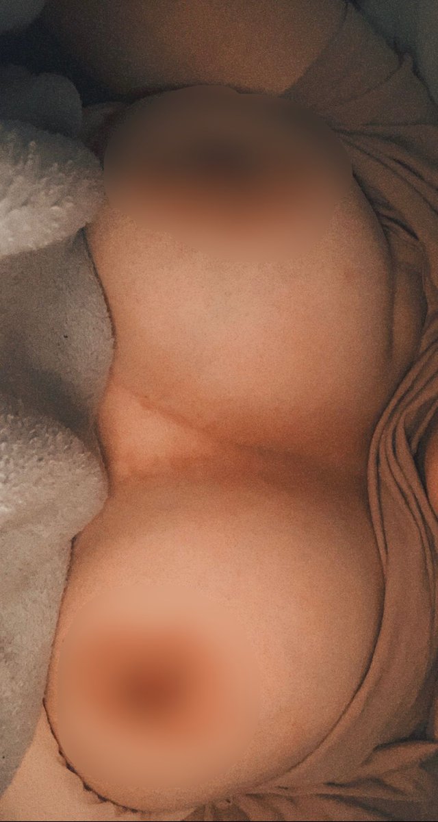 UKWhorex's tweet photo. I Know You Wanna See These Massive Tits Uncensored So What Are U Waiting For Daddy? 💦, Dm Now Or Add My Snap!

#sellingcontent #buyingcontent #findom #paypig #domme #loser #brat #cashcow #humanatm #finsub #walletdrain #nsfw #beta #nsfwtwt #sellingcontents https://t.co/Q0K5wbf3OW