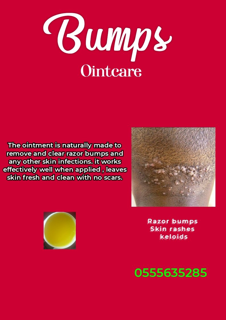 <a href="/Accra_Packaging/">Accra and Packaging 🇬🇭</a> <a href="/johniDjangma/">j.o.djangmah</a> CLEAR those skin issues, razor bumps,  keloids, etc this ointment.

For personal use and bulk purchase call or Dm.