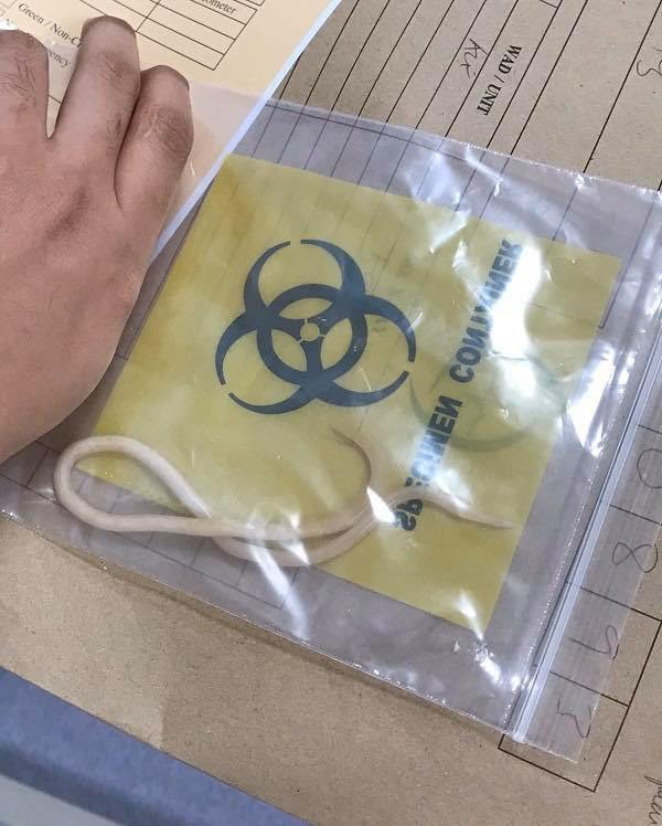 aemeruls_'s tweet photo. Maaf sebab share benda ngeri ni. Just nak ingatkan korang untuk makan ubat cacing. Yang kaki makan separuh masak &amp; mentah especially sushi, sashimi, oyster korang paling kena jaga-jaga

Amalkan makan 6 bulan sekali dewasa &amp; kanak-kanak. Tips jimat aku share bawah ni👇 https://t.co/bTftCVuke9