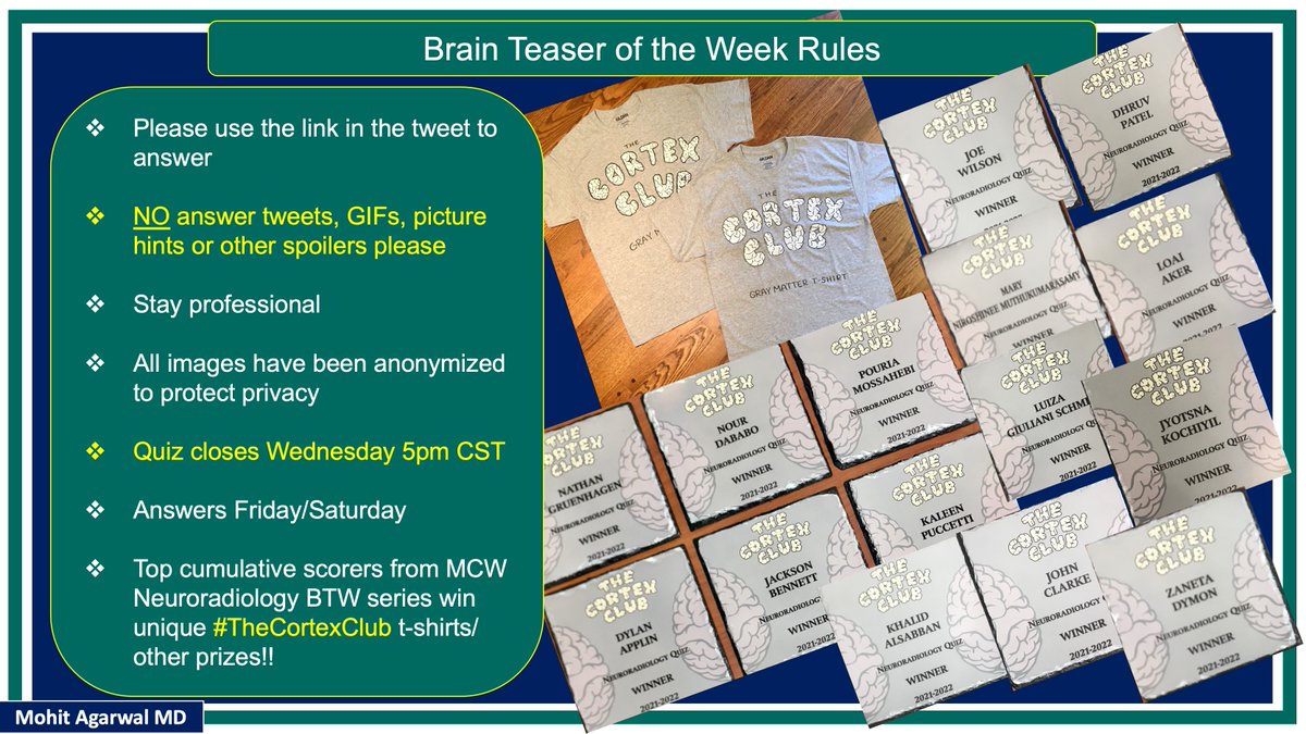 @X (@publishedxprime) on Twitter photo #MCWNeuroradBTW 093:Headache
HNY!🎉
QUIZ OPENS MON,CLOSES THU5PM
NO ANS/HINTS IN COMMENTS
Submit answers@ mcwisc.co1.qualtrics.com/jfe/form/SV_8q…
#radres #MedEd #MedTwitter
<a href="/TheASNR/">The American Society of Neuroradiology</a> <a href="/ARRS_Radiology/">ARRS</a> <a href="/BSHNI_UK/">British Society of Head & Neck Imaging</a> <a href="/AwanRad/">Omer Awan MD MPH</a> <a href="/RadDiscord/">RadDiscord</a> <a href="/MCWNeurorad/">MCW Neuroradiology</a> <a href="/ShivaprakashBH4/">Shivaprakash B. Hiremath</a> <a href="/RamVaidhyanath/">Ram Vaidhyanath</a> <a href="/drmanasiarora/">Manasi Arora</a> #MCWNeuroradBTW 093:Headache
HNY!🎉
QUIZ OPENS MON,CLOSES THU5PM
NO ANS/HINTS IN COMMENTS
Submit answers@ mcwisc.co1.qualtrics.com/jfe/form/SV_8q…
#radres #MedEd #MedTwitter
<a href="/TheASNR/">The American Society of Neuroradiology</a> <a href="/ARRS_Radiology/">ARRS</a> <a href="/BSHNI_UK/">British Society of Head & Neck Imaging</a> <a href="/AwanRad/">Omer Awan MD MPH</a> <a href="/RadDiscord/">RadDiscord</a> <a href="/MCWNeurorad/">MCW Neuroradiology</a> <a href="/ShivaprakashBH4/">Shivaprakash B. Hiremath</a> <a href="/RamVaidhyanath/">Ram Vaidhyanath</a> <a href="/drmanasiarora/">Manasi Arora</a>