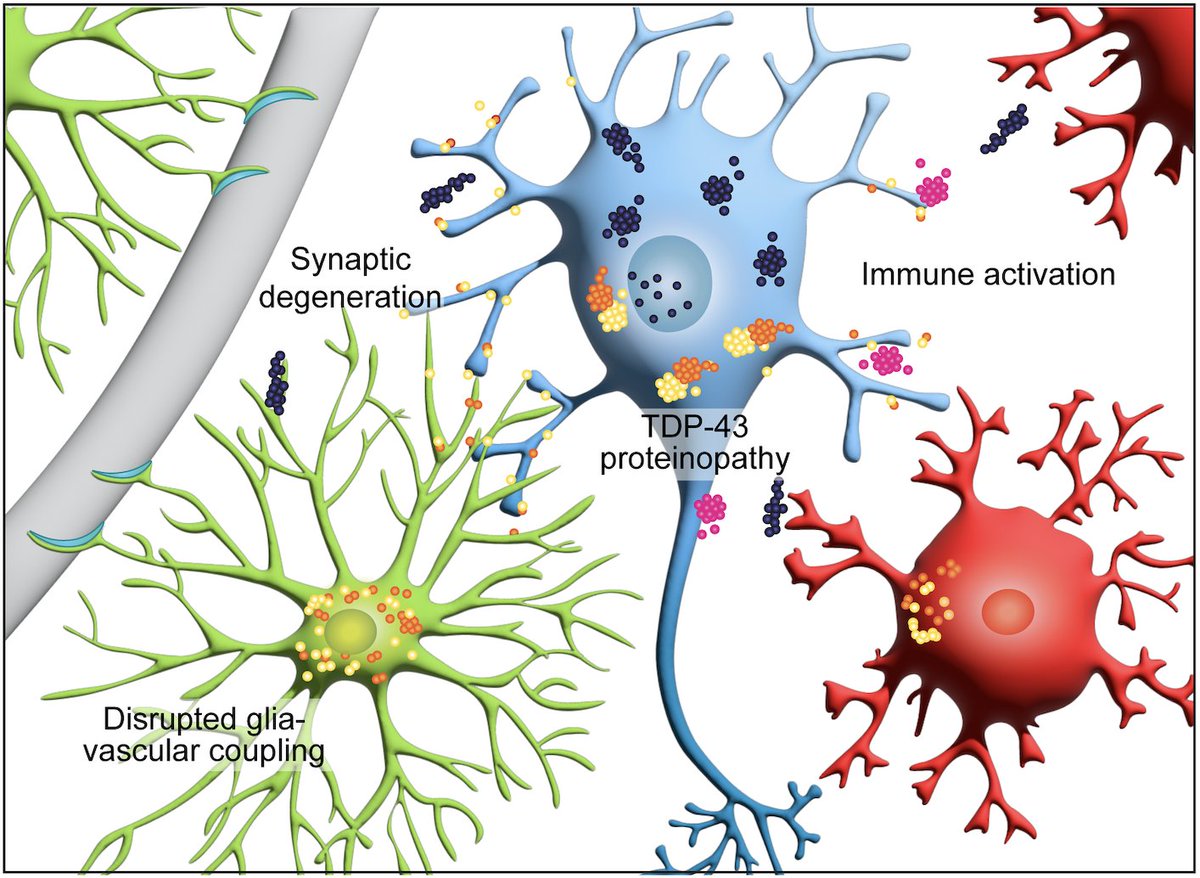Elise Marsan (@elisemarsan) on Twitter photo Our paper is out! Want to know more about human and mouse astroglial toxicity in FTLD-GRN thalamo-cortical circuit? jci.org/articles/view/… #scRNAseq #Organoids Fantastic collabs with <a href="/Kriegsteinlab/">Arnold Kriegstein</a> <a href="/UllianLab/">Ullian Lab</a> <a href="/immunox/">UCSF Bakar ImmunoX Initiative</a> and support from <a href="/AFARorg/">AFAR</a> <a href="/_BrightFocus/">BrightFocus Foundation</a> <a href="/BluefieldProj/">Bluefield Project</a> Our paper is out! Want to know more about human and mouse astroglial toxicity in FTLD-GRN thalamo-cortical circuit? jci.org/articles/view/… #scRNAseq #Organoids Fantastic collabs with <a href="/Kriegsteinlab/">Arnold Kriegstein</a> <a href="/UllianLab/">Ullian Lab</a> <a href="/immunox/">UCSF Bakar ImmunoX Initiative</a> and support from <a href="/AFARorg/">AFAR</a> <a href="/_BrightFocus/">BrightFocus Foundation</a> <a href="/BluefieldProj/">Bluefield Project</a>