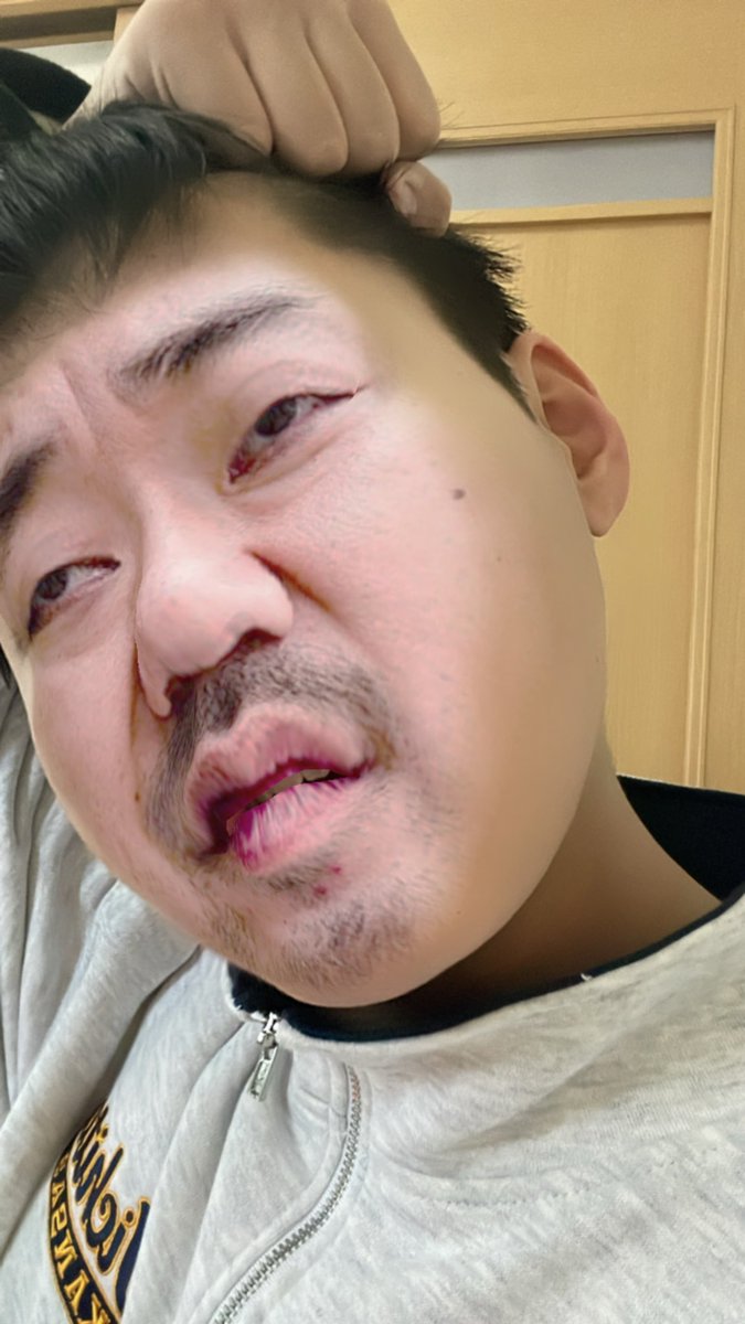 koooooday1017's tweet photo. みんな久しぶりツーブロにしたよ https://t.co/wzG9pRaLqx