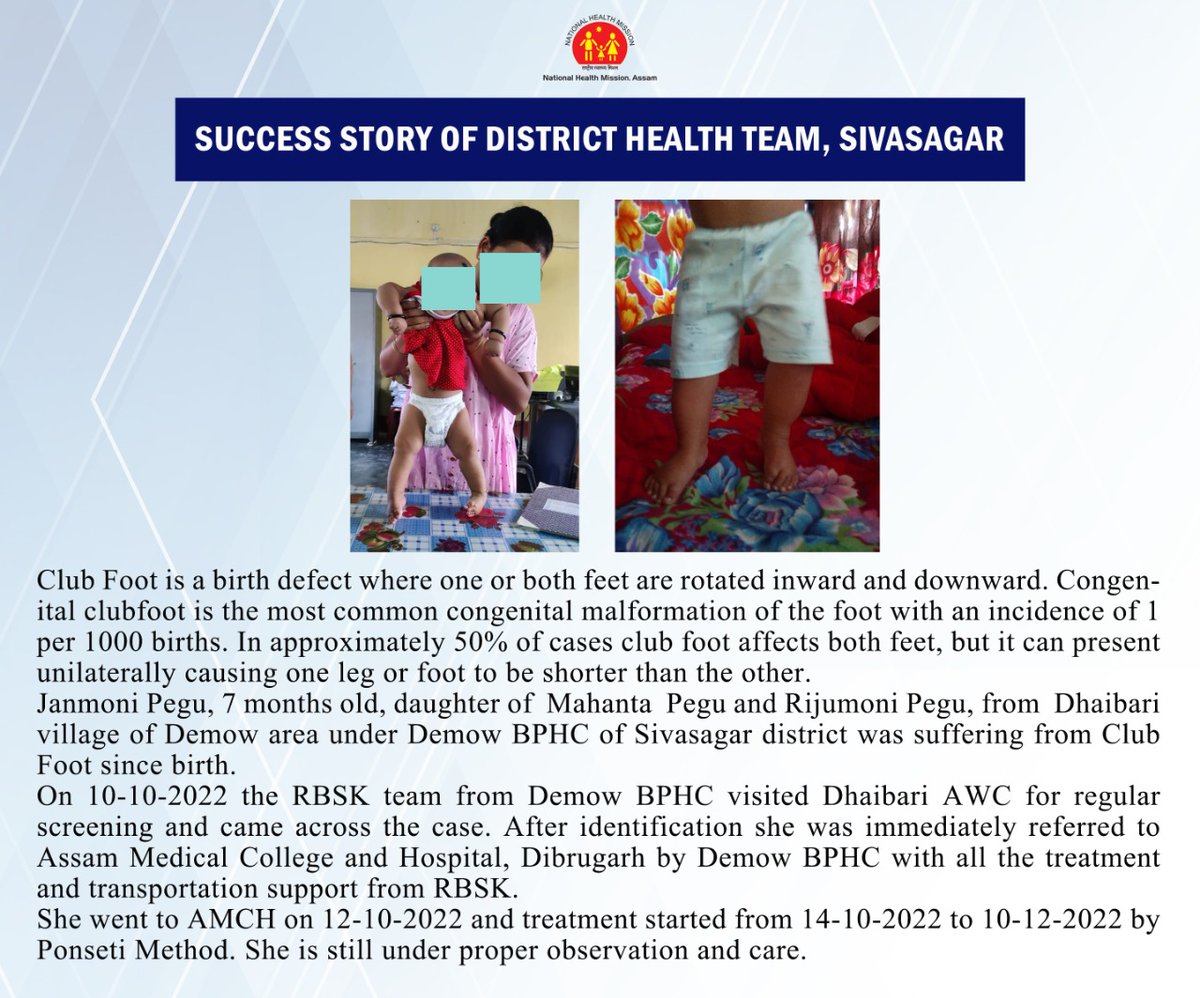 Well done District Health Team, Sivasagar for successful identification and referral of a Club Foot case. We congratulate the team for their work.

<a href="/NSivsagar/">NHM,SIVSAGAR</a>