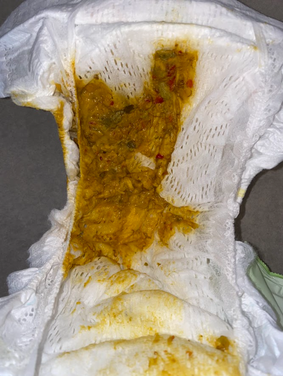 DookieDiaper's tweet photo. Did you know that virtual baby poop NFTs are actually easier to clean up than the real thing? While a physical diaper full of doodoo requires a thorough wash and dispose, all you have to do with a digital version is click 'delete' and it's gone in an instant. #NFT #babypoo https://t.co/ofaPKg9veX