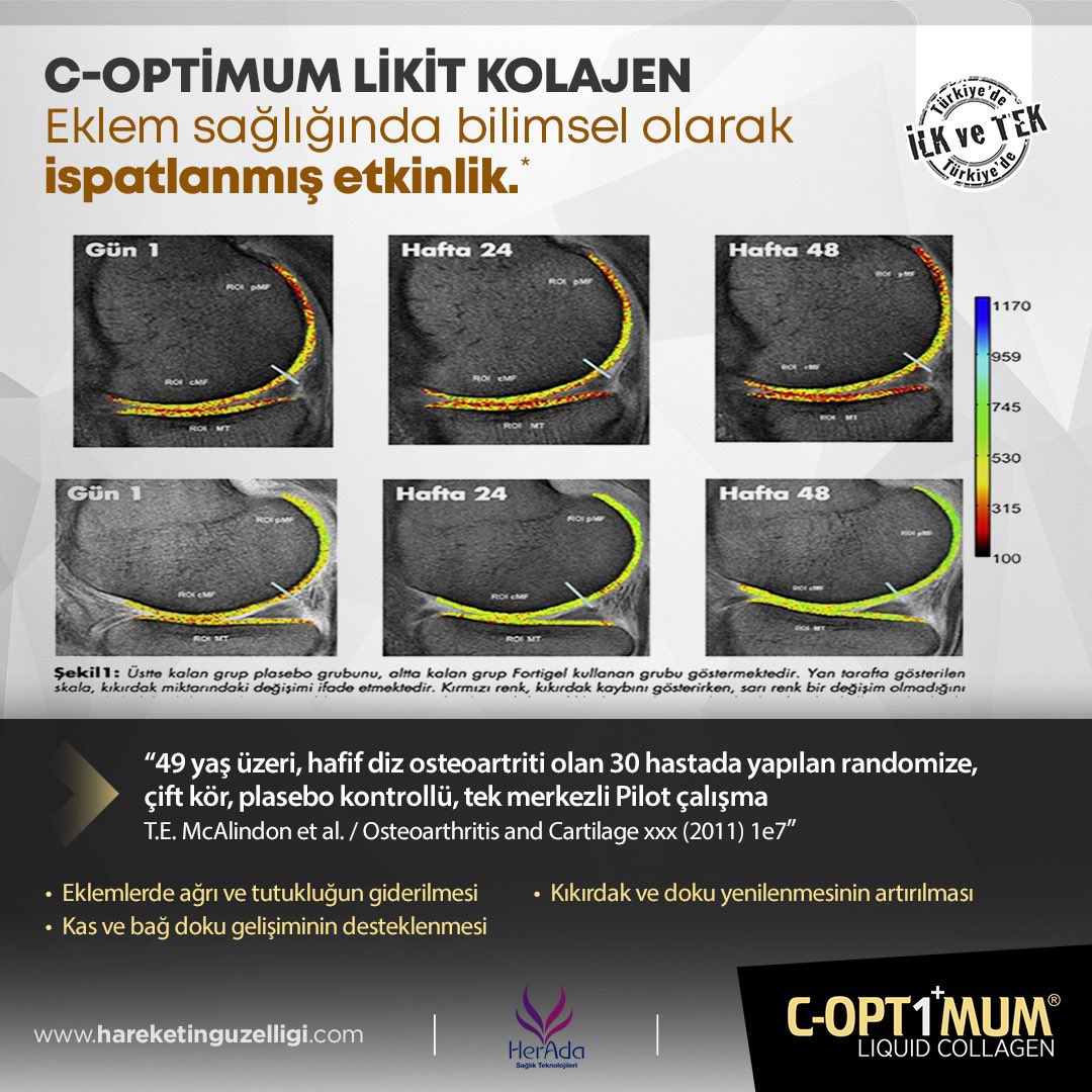 coptimumtr's tweet photo. 🦵🏼 Eklem sağlığında mükemmel 
formülasyon başarısı C-Optimum’da

***
#hareketingüzelliği #sağlık #eklemağrısı
#liquid #collagen #coptimum #herada #likit #kolajen #osteoartrite https://t.co/XiaEHZu9Pg