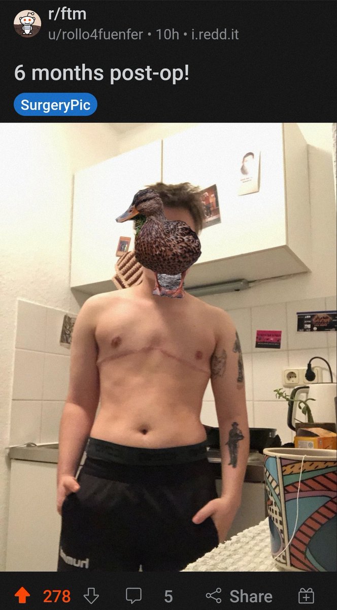 Man that's an awesome chest!