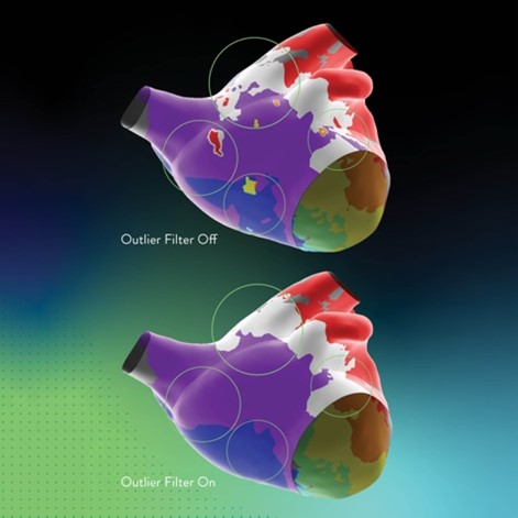 Abbott Cardiovascular (@abbottcardio) on Twitter photo Discover how our #EnSiteX Software Version 2 is bringing cleaner maps and reduced editing times to your #EPLab with automatic removal of outliers and more.
Explore the new features: cardiovascular.abbott/us/en/hcp/prod… 
Safety Info: cardiovascular.abbott/us/en/hcp/prod… Discover how our #EnSiteX Software Version 2 is bringing cleaner maps and reduced editing times to your #EPLab with automatic removal of outliers and more.
Explore the new features: cardiovascular.abbott/us/en/hcp/prod… 
Safety Info: cardiovascular.abbott/us/en/hcp/prod…