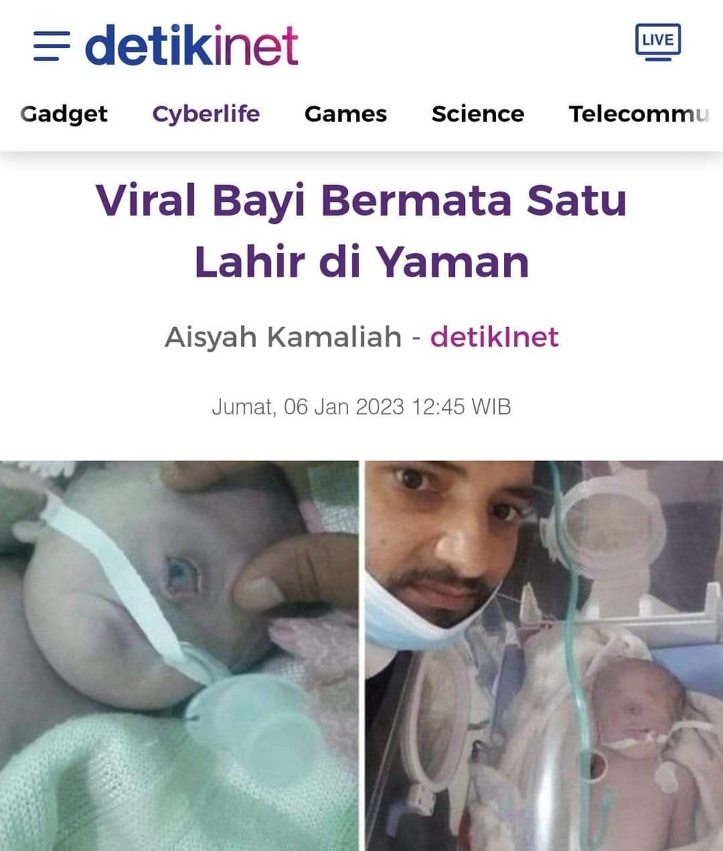 Tita83079013's tweet photo. Fenomena apa ini datang dari yaman ... https://t.co/CwHABf20lc