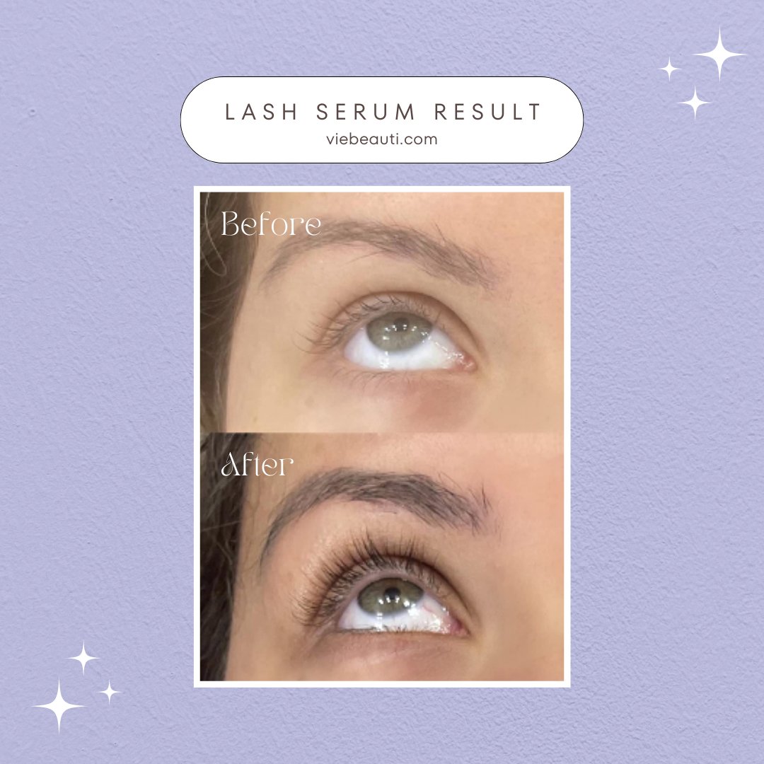 viebeauti's tweet photo. "The beauty industry's best-kept secret is out!
Its natural ingredients and magnificent results have me feeling like the most beautiful version of myself 💜" - Annie
#viebeauti #viebeautilashserum #lashserumresults #lashgame #lashroutine #lashbooster #lashenhancer https://t.co/9Mdf9KNaoW