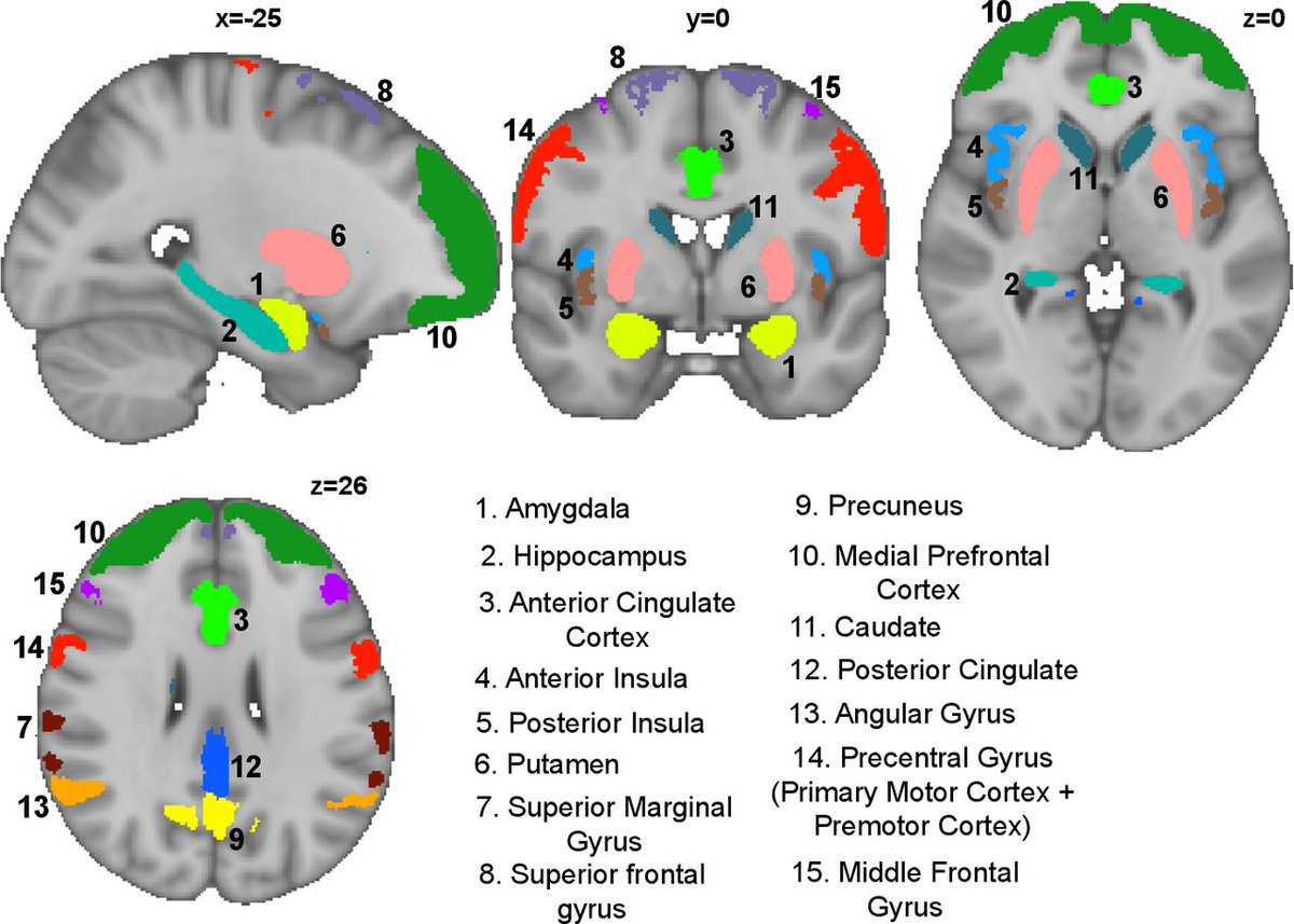 Brain activity measured by functional brain imaging predicts breathlessness improvement during pulmonary rehabilitation thorax.bmj.com/content/early/… #COPD