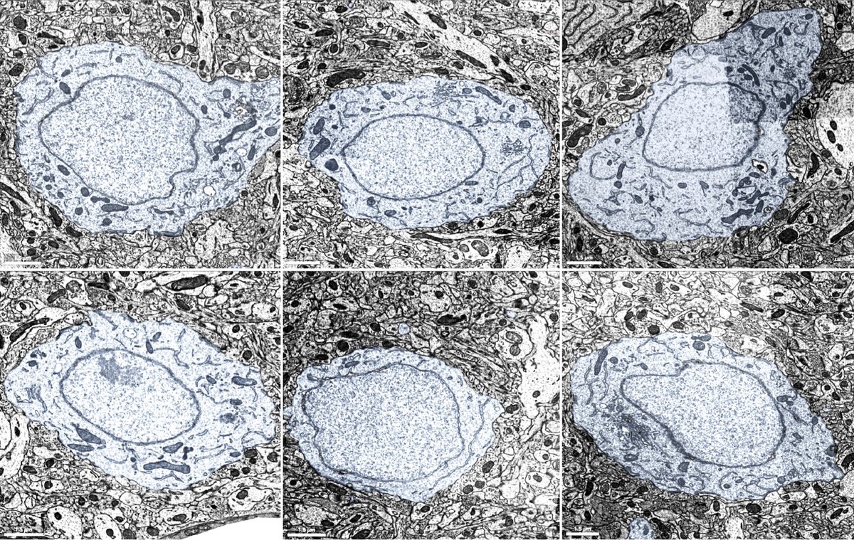 HaniehFalahati's tweet image. #EM_Monday again! These are randomly selected cell bodies, close to the nucleus periphery, of 6 inhibitory (red) and 6 excitatory (blue) neurons from layer 2/3 of microns-explorer.com. Do you notice any differences? @YaleCellBio