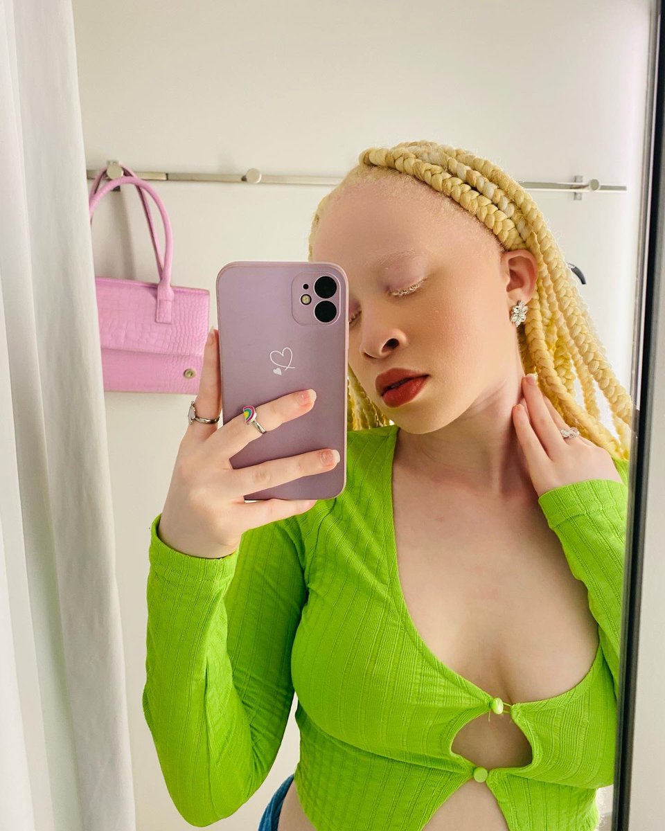 sunshine_sane's tweet photo. Seeing green 😊
.
.
#Londie #babewodumo #JobSeekersSA https://t.co/FRSmVyESOV