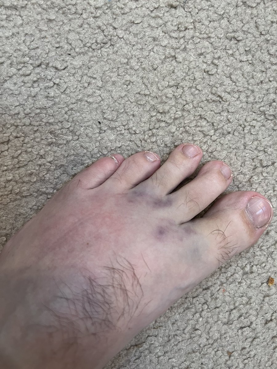 CoachGreiser's tweet image. #softballproblems