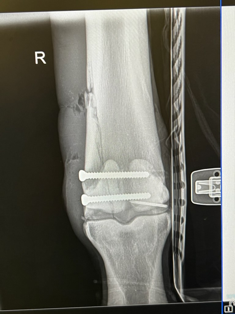 DJFiske's tweet image. #EPICENTER 
How it started / How it’s going…
remarkable physical and temperament given what all he’s been through- surgery, confinement, -6 degrees.
@coolmoreamerica @BreedersCup