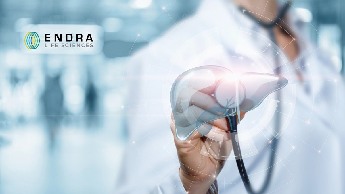 endralifesci's tweet photo. Primary care providers should be aware: prevalence of #NAFLD is rising in the US population, and early disease recognition and risk stratification is important to reduce morbidity associated with the disease.
https://t.co/w1DAR3BXxr
#endra #nash #ndra $ndra @endralifesci https://t.co/pFe0Fx9VEE