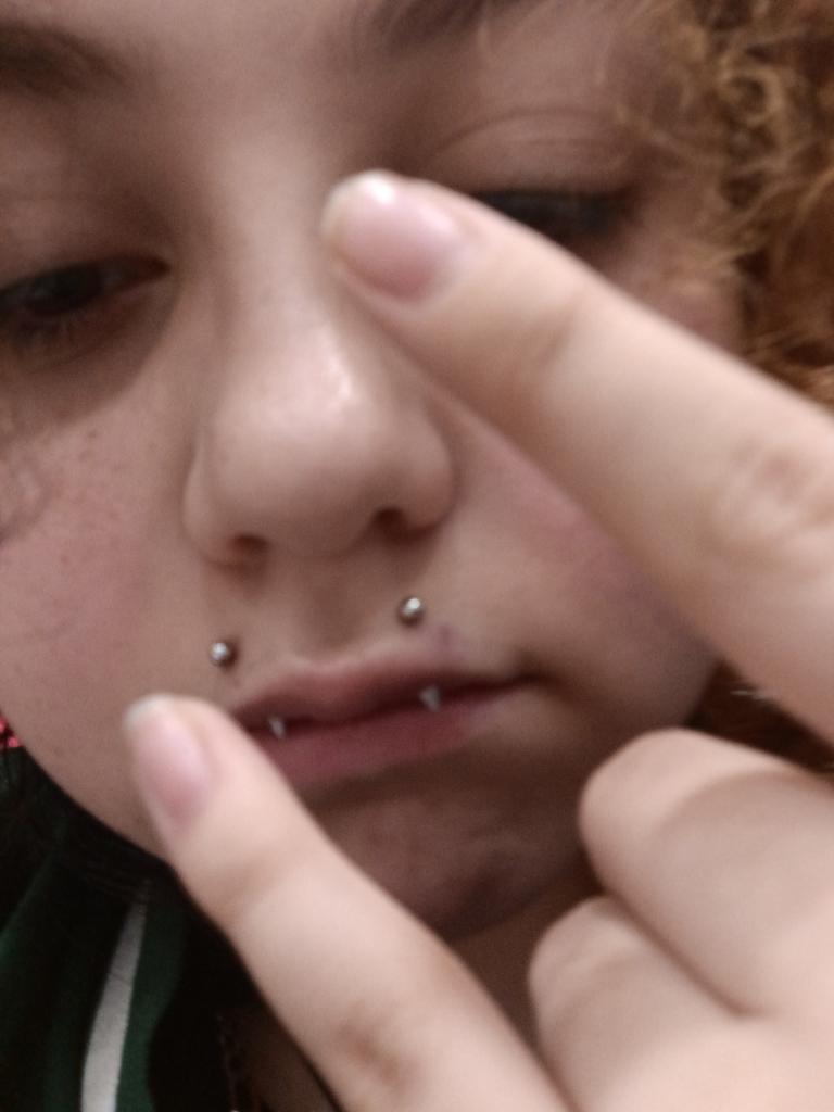 cheesewpretzels's tweet image. pierced my lips lmao #angelfangs
#verticalangelbites #piercing