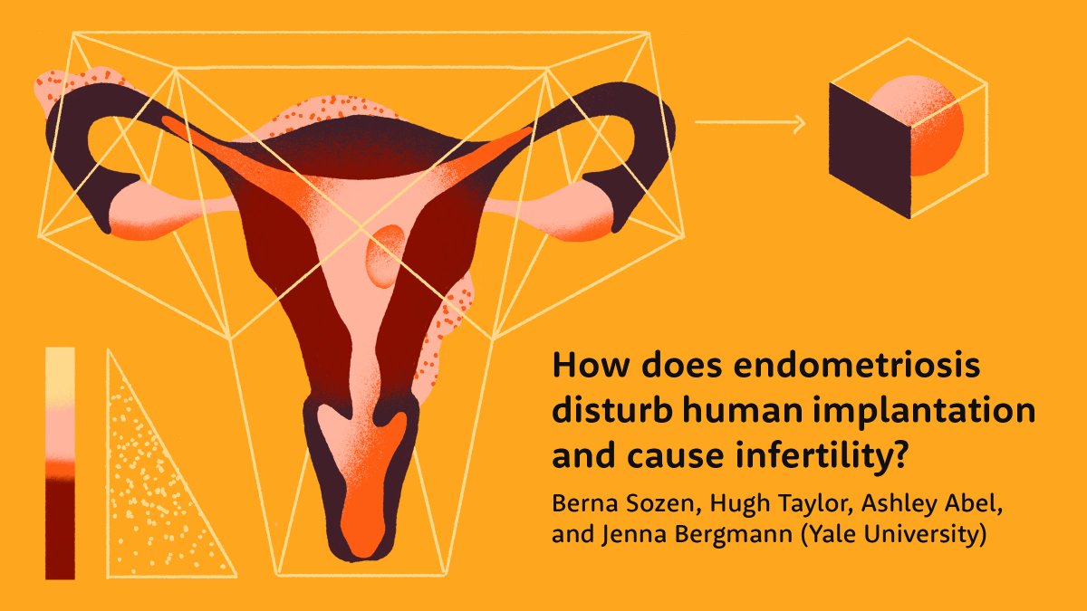 Sara Kemppainen (@sarakemppainen) on Twitter photo Repro Grant #1! <a href="/BernaSozen_/">Berna Sozen</a> & Hugh Taylor.
Endometriosis is associated with infertility but we don't know exactly why! And we can't just open the pregnant body and see.
This group is building a novel 3D model of early human development to study how endo may deter implantation. Repro Grant #1! <a href="/BernaSozen_/">Berna Sozen</a> & Hugh Taylor.
Endometriosis is associated with infertility but we don't know exactly why! And we can't just open the pregnant body and see.
This group is building a novel 3D model of early human development to study how endo may deter implantation.