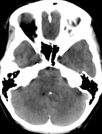 Daniel Gewolb, MD tweet media