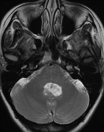 Daniel Gewolb, MD tweet media