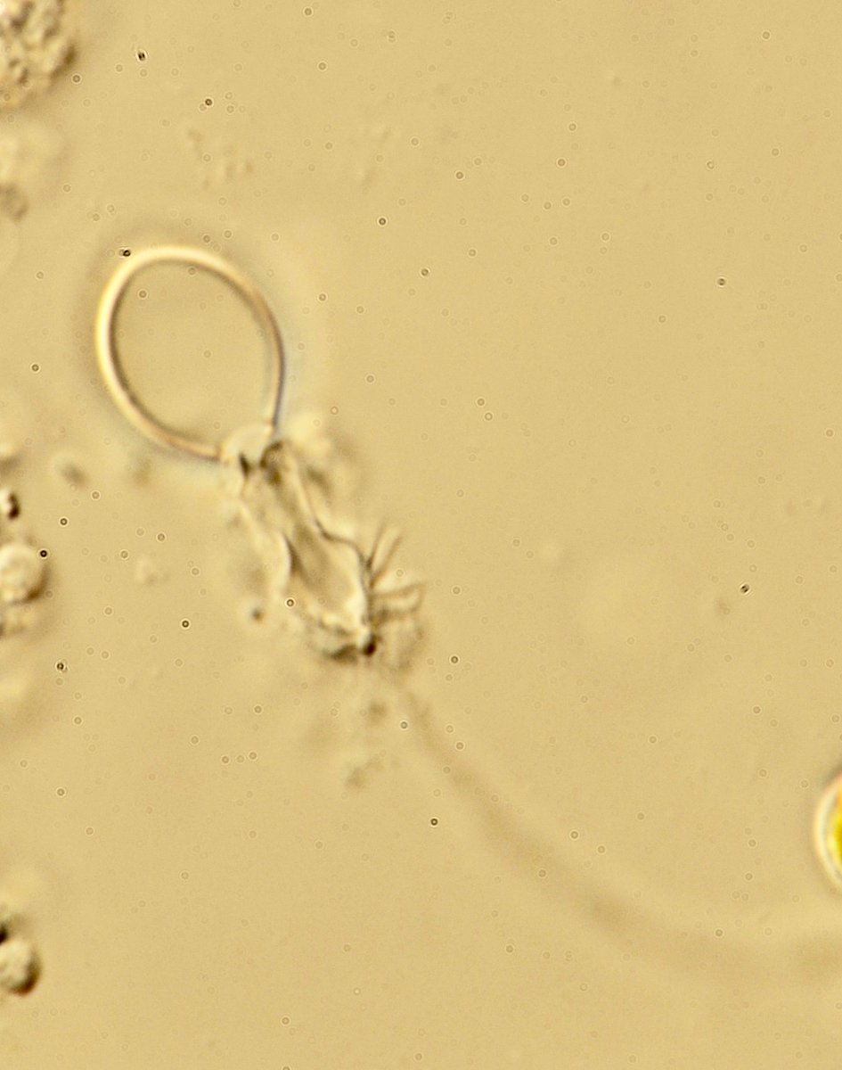 Hey! My name is Anna and I explore cnidarian venom systems and how they change. Currently I’m a <a href="/NSF/">U.S. National Science Foundation</a> #PRFB Post-doc with <a href="/Gibson_Lab/">Gibson Lab</a> exploring stinging cell assembly in Nematostella. 

I also like to regularly tweet reminders of how cool hydroids are through #Hype4Hydrozoa!