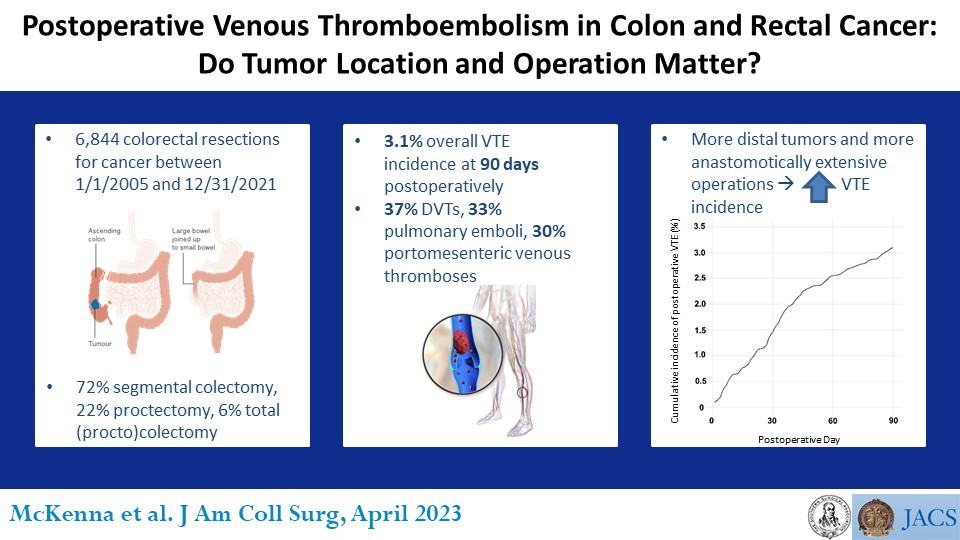 Journal of the American College of Surgeons (JACS) (@acsjacs) on Twitter photo New Today: VTE risk after #colorectal surgery for #cancer may extend to 90 days postoperatively and be increased by operation performed and operative extent.
ow.ly/fLkv50Mltin
<a href="/NPMcKenna/">Nicholas McKenna</a> <a href="/MayoClinic/">Mayo Clinic</a> <a href="/EBHabermann/">Liz Habermann, PhD MPH</a> New Today: VTE risk after #colorectal surgery for #cancer may extend to 90 days postoperatively and be increased by operation performed and operative extent.
ow.ly/fLkv50Mltin
<a href="/NPMcKenna/">Nicholas McKenna</a> <a href="/MayoClinic/">Mayo Clinic</a> <a href="/EBHabermann/">Liz Habermann, PhD MPH</a>