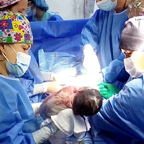 En el año 2022 el Hospital Central atendió más de 3 mil nacimientos, entre partos naturales y cesáreas, con 26 nacimientos dobles y uno de trillizos. @nicolasmaduro @magalygutierrezv
@mppsalud_vzla @freddybernalven
@gobernaciondeltachira
@corposalud_tachira #juntosporcadalatido