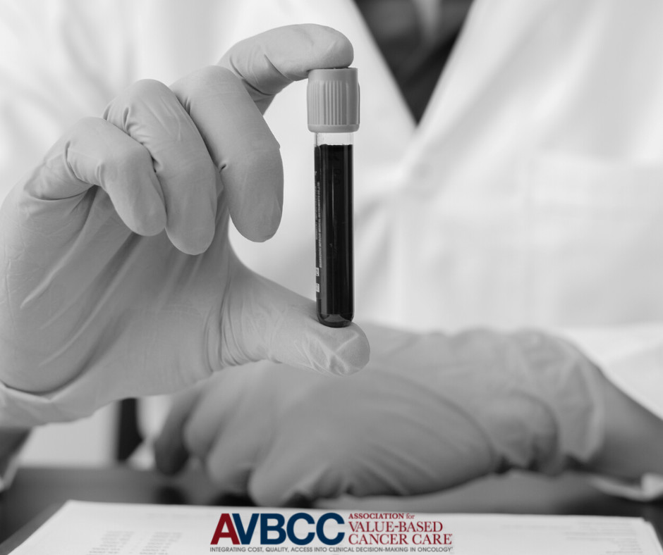New results from the PATHFINDER clinical trial suggest that Galleri, a new multicancer #earlydetection blood test, can accurately identify the presence of more than 50 cancer types in apparently healthy people. Learn more: bit.ly/3Qnep8i #AVBCC