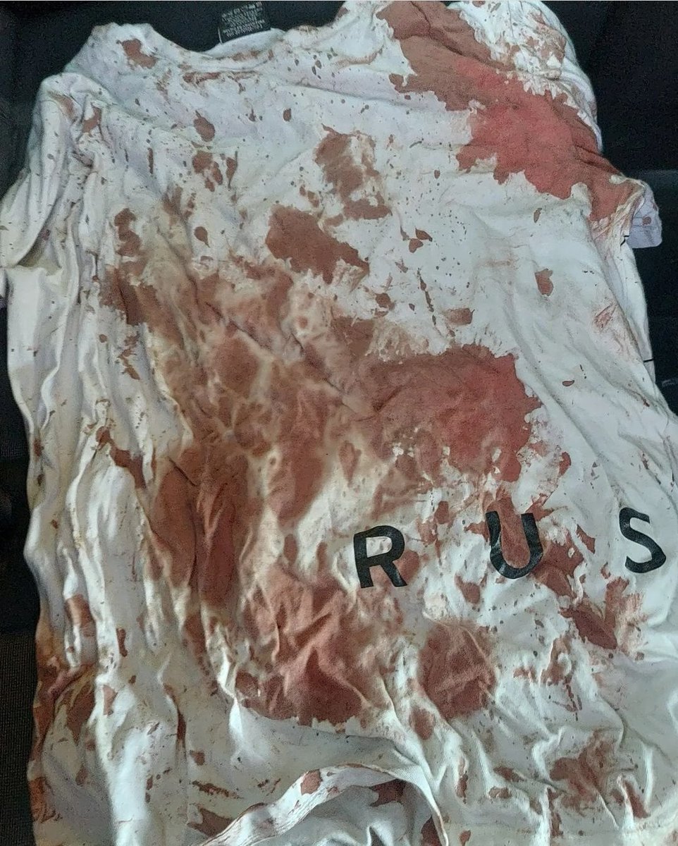 nachomoroni's tweet photo. Esto pasó en el boliche Club Leloir de #Lanús.

El domingo pasado Tomás salia a festejar su cumpleaños y fue agredido por el personal de seguridad del lugar. Lo llevaron a "donde no enfocan las cámaras" para atacarlo hasta casi dejarlo inconsciente. Gravísimo. https://t.co/4E7pirwhT7